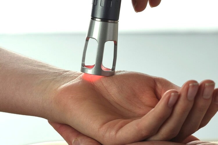 لیزر تراپی برای درمان انگشت ماشه‌ای