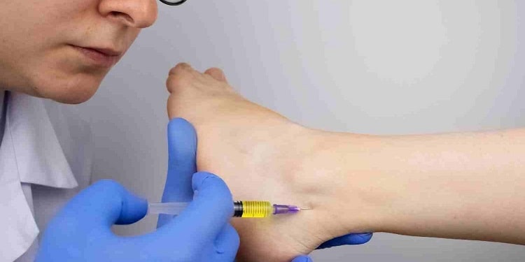 تزریق استروئید برای درمان پیچ خوردگی مچ پا